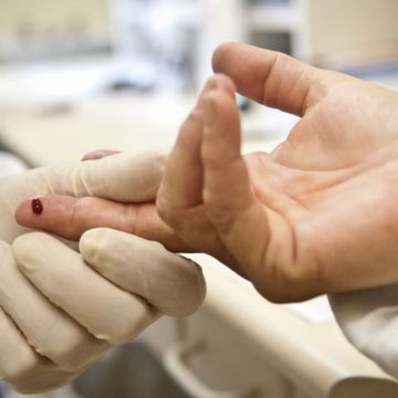 Afastada indenização a homem que teve resultado falso-positivo em teste de HIV